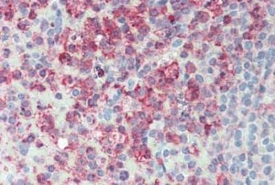 Immunohistochemistry-Paraffin: ERMP1 Antibody [NBP3-14315]